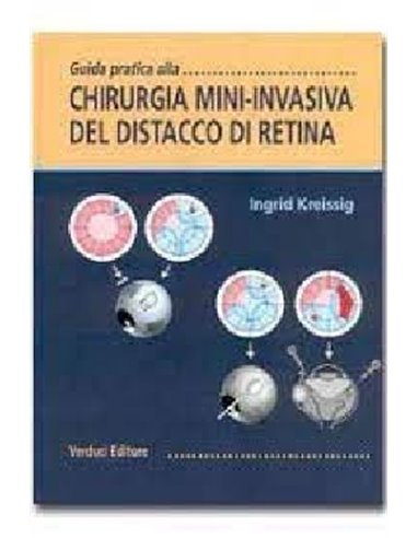 Guida pratica alla chirurgia mini-invasiva del distacco di retina