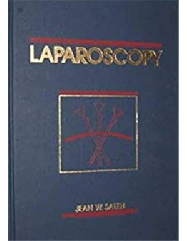 Laparoscopy