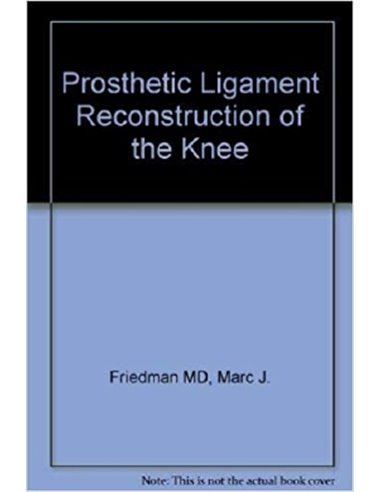 Prosthetic ligament reconstruction of the knee