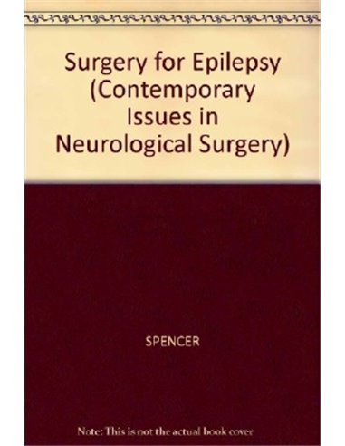 Surgery for epilepsy