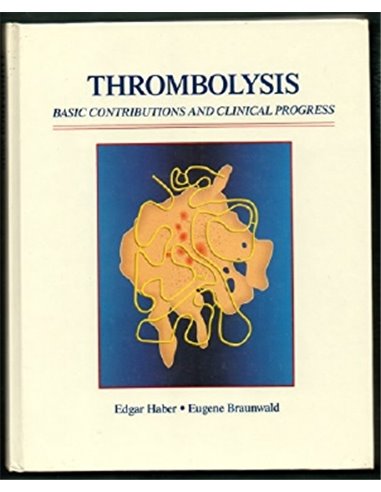 Thrombolysis basic contributions and clinical progress