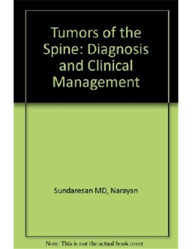 Tumors of the spine diagnosis and clinical management