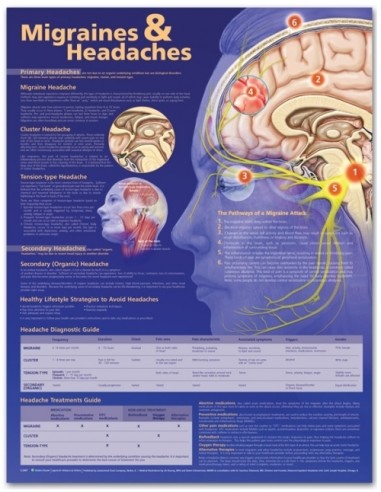 Migraines & Headaches Anatomical Chart
