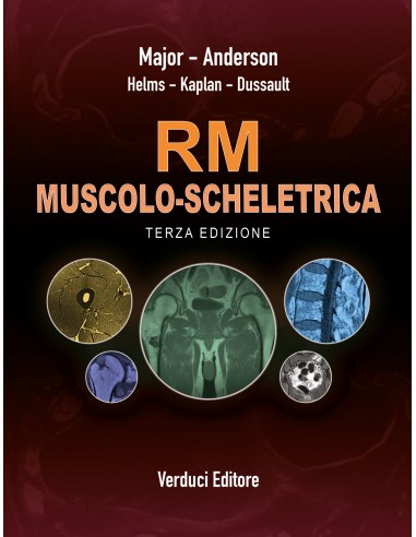 Risonamza  Magnetica (RM...