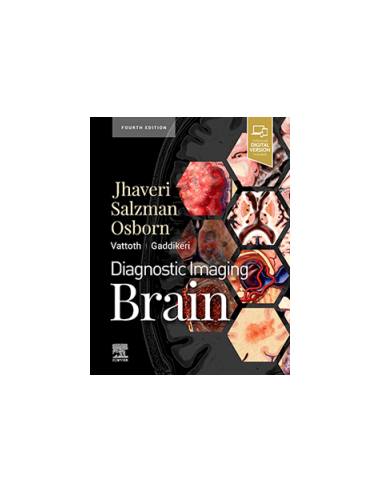 Diagnostic Imaging: Brain 4/e 2021