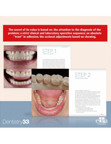 3STEP: additive prosthodontics 1/e 2022