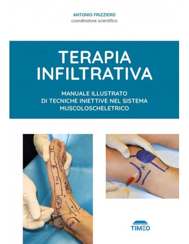 Terapia infiltrativa. Manuale...