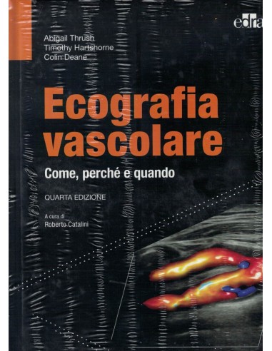Ecografia vascolare. Come, perché e...