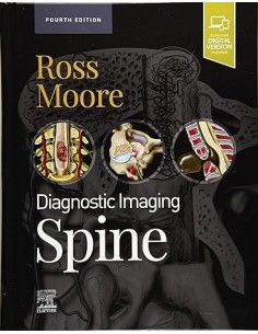Diagnostic Imaging: Spine,...