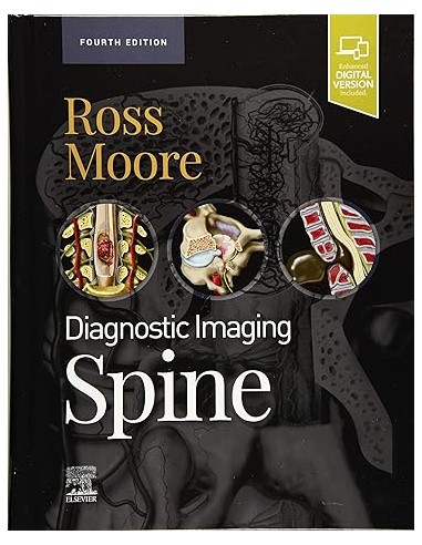 Diagnostic Imaging: Spine, 4/e 2022