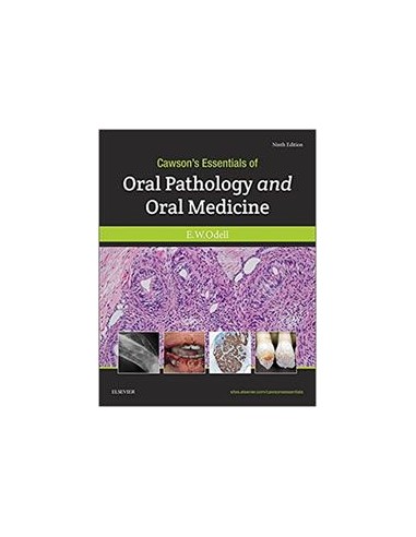 Cawson's Essentials of Oral Pathology...
