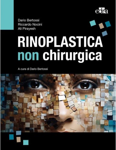 Rinoplastica non chirurgica 1/2024